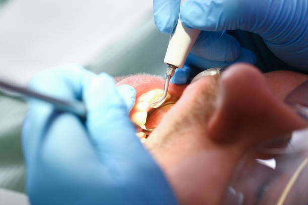 Best Urgent Dental Care for Toothache in Sappington, MO