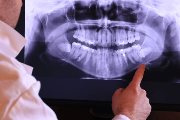 Best Emergency Dentist for Lost Fillings or Crowns in Sappington, MO