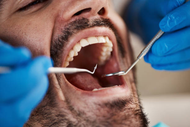 Best Emergency Dental Care for Abscessed Tooth in Sappington, MO